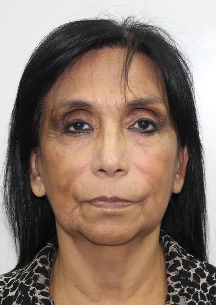 Imagen de perfil de Auristela Ana Obando Morgan